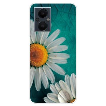 Deco OnePlus Nord N20 5G Etui - Daises