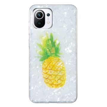 Marble Xiaomi Mi 11 Lite 5G / Mi 11 Lite Etui - Ananas